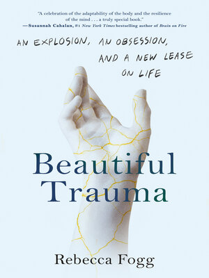 cover image of Beautiful Trauma